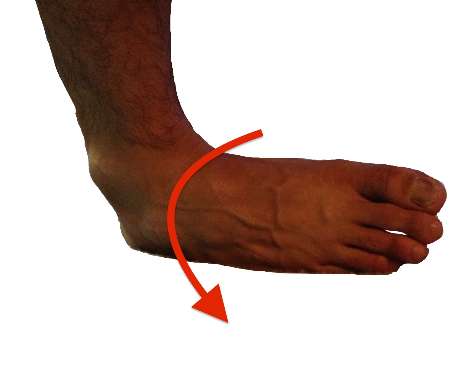 ankle sprain