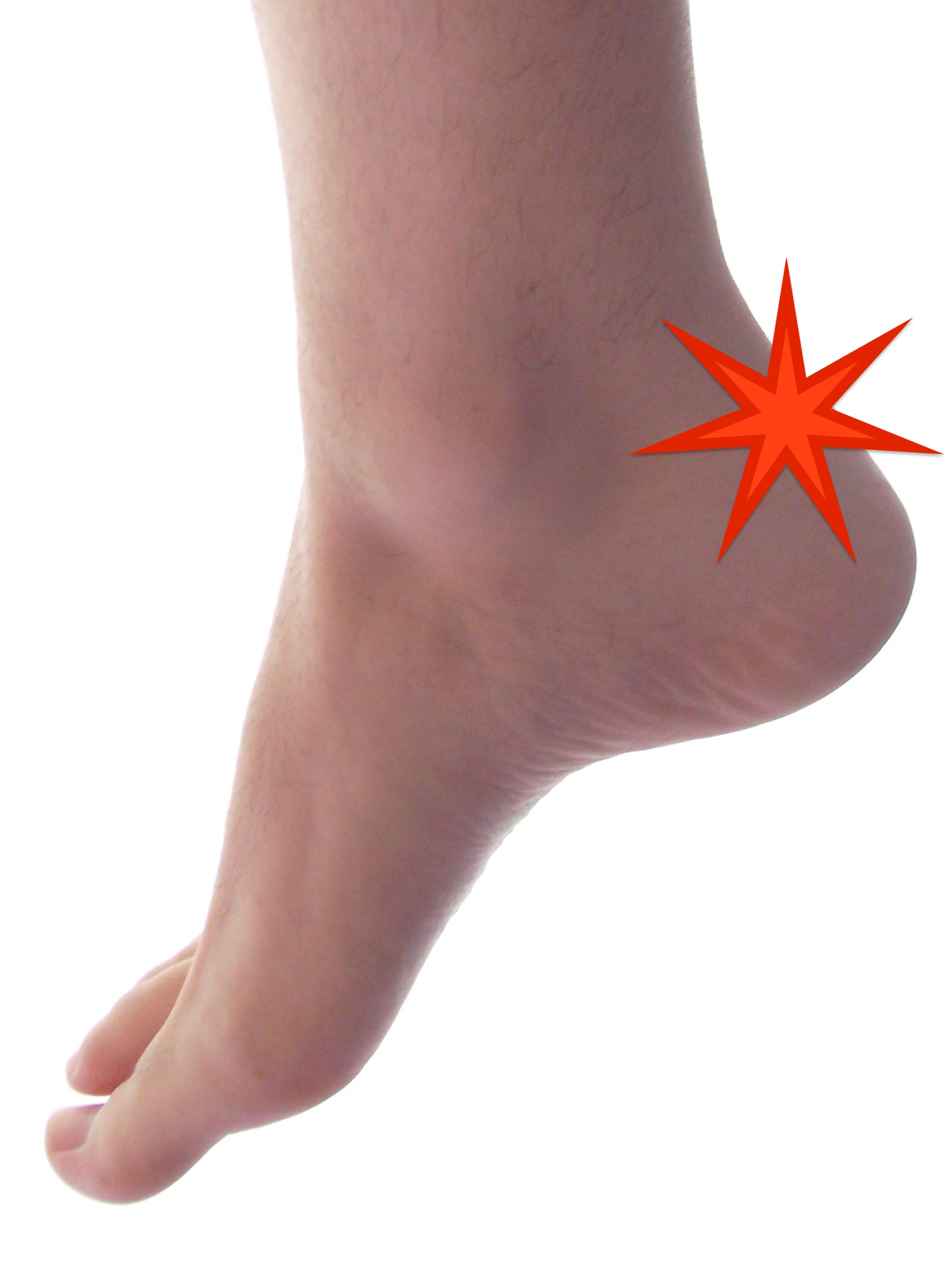 pain on the back of the heel