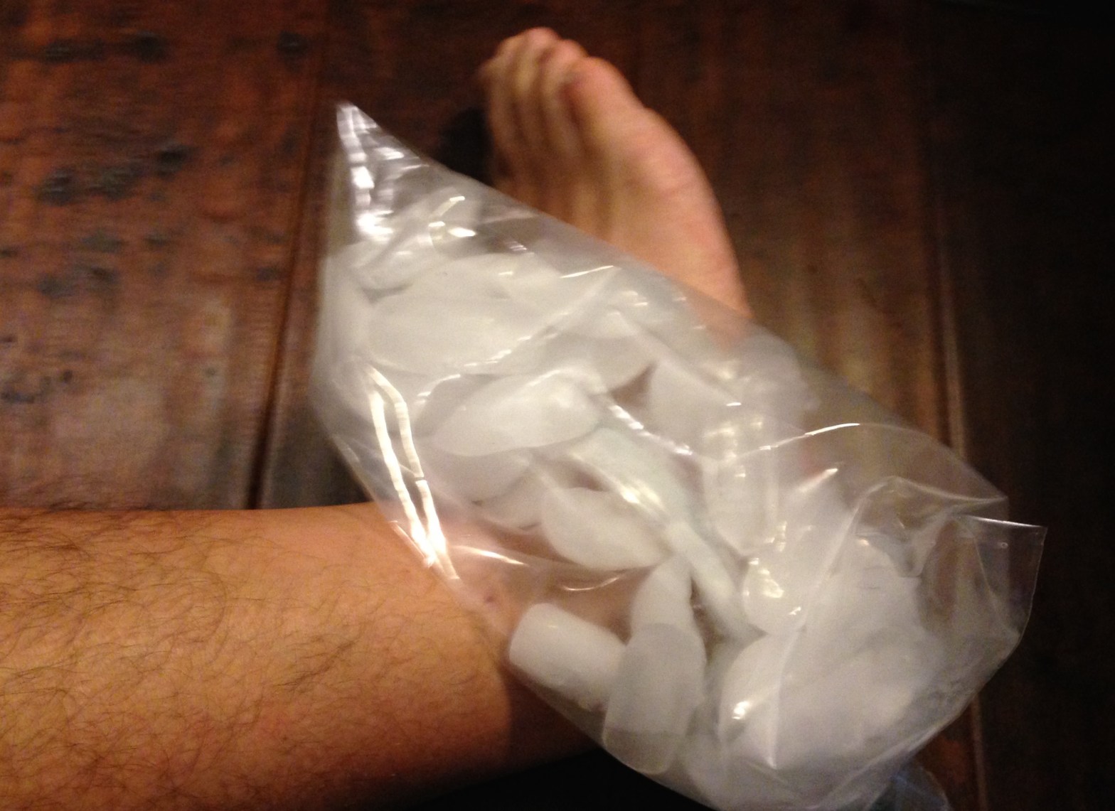 sprained ankle