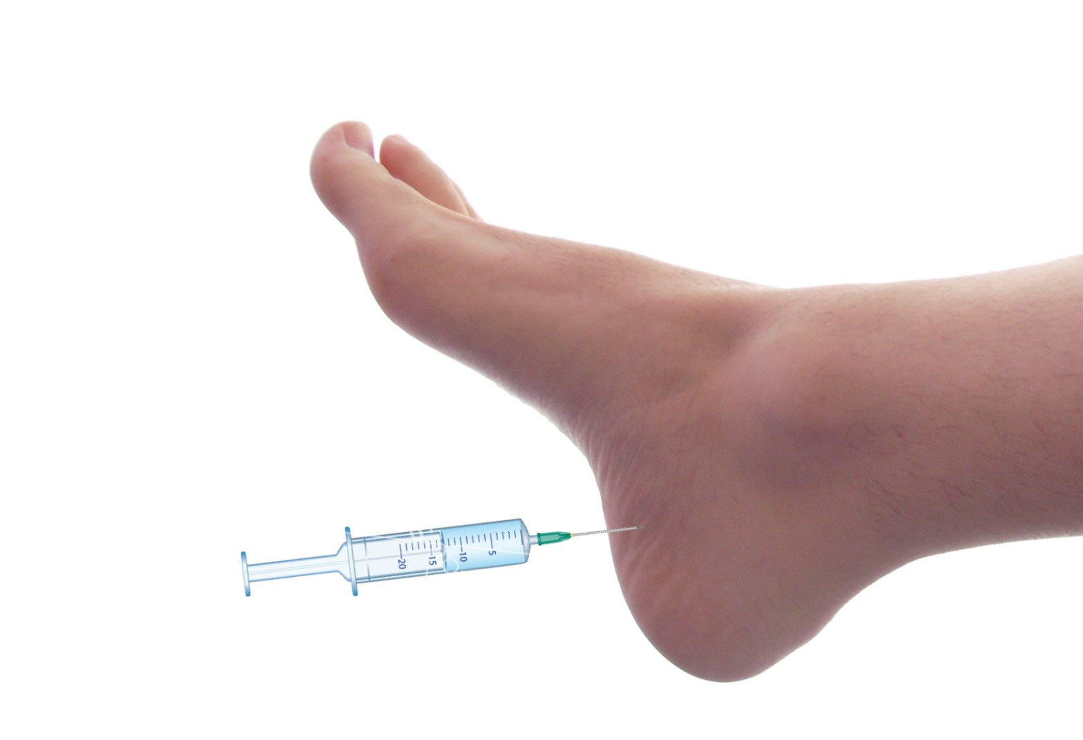 heel pain injection