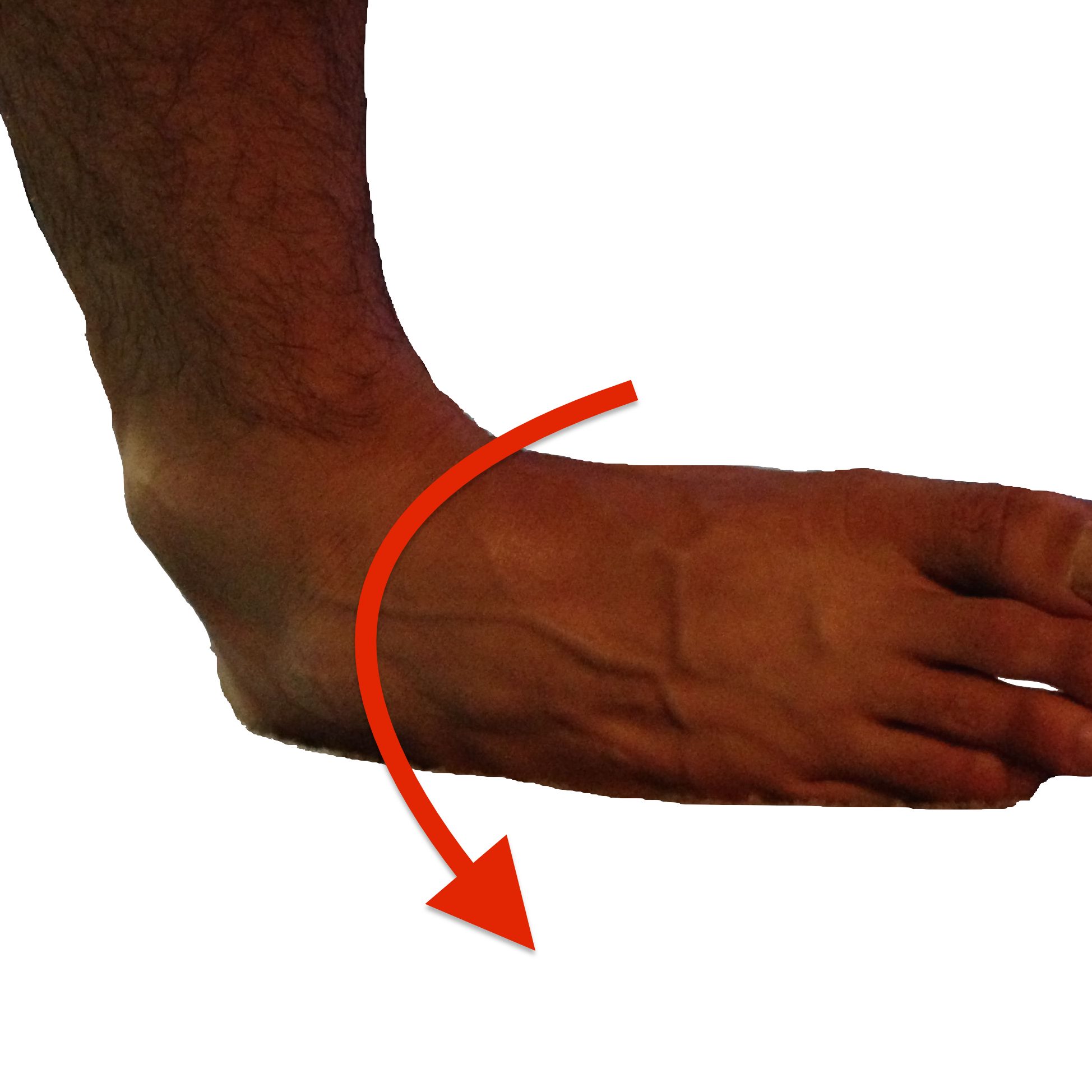 ankle sprain