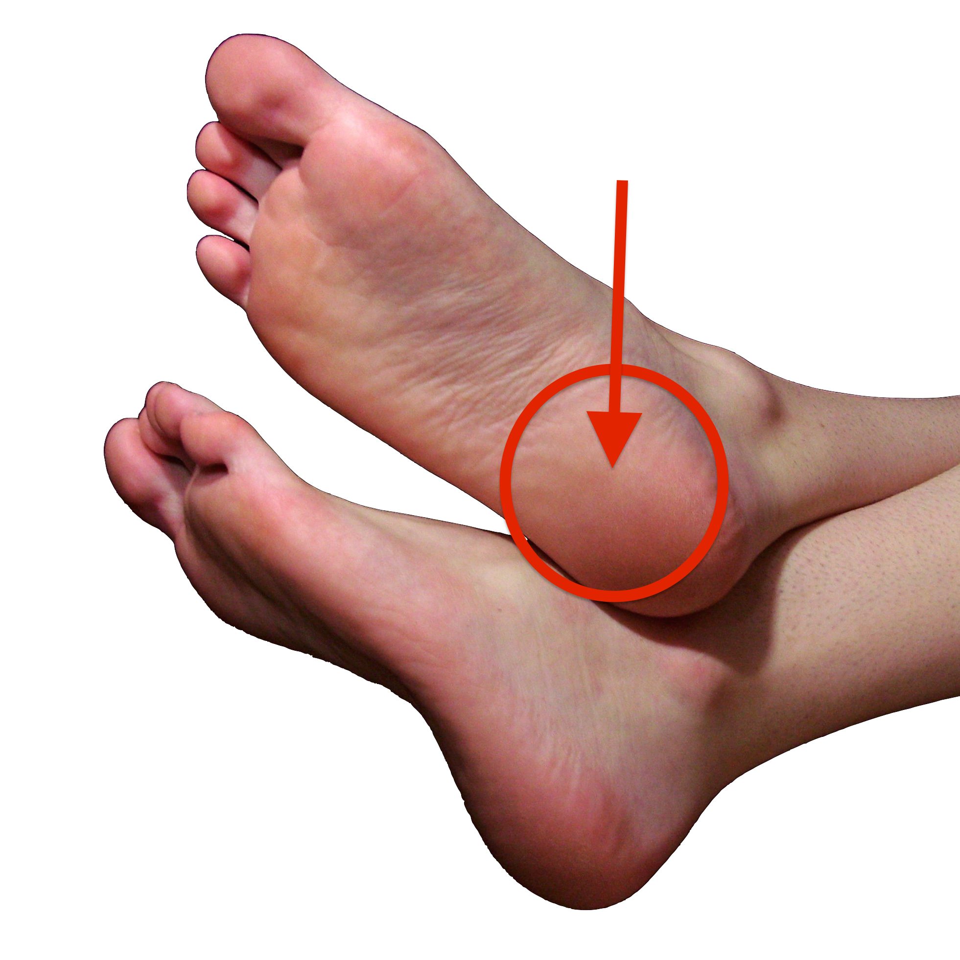 pain on the bottom of the heel