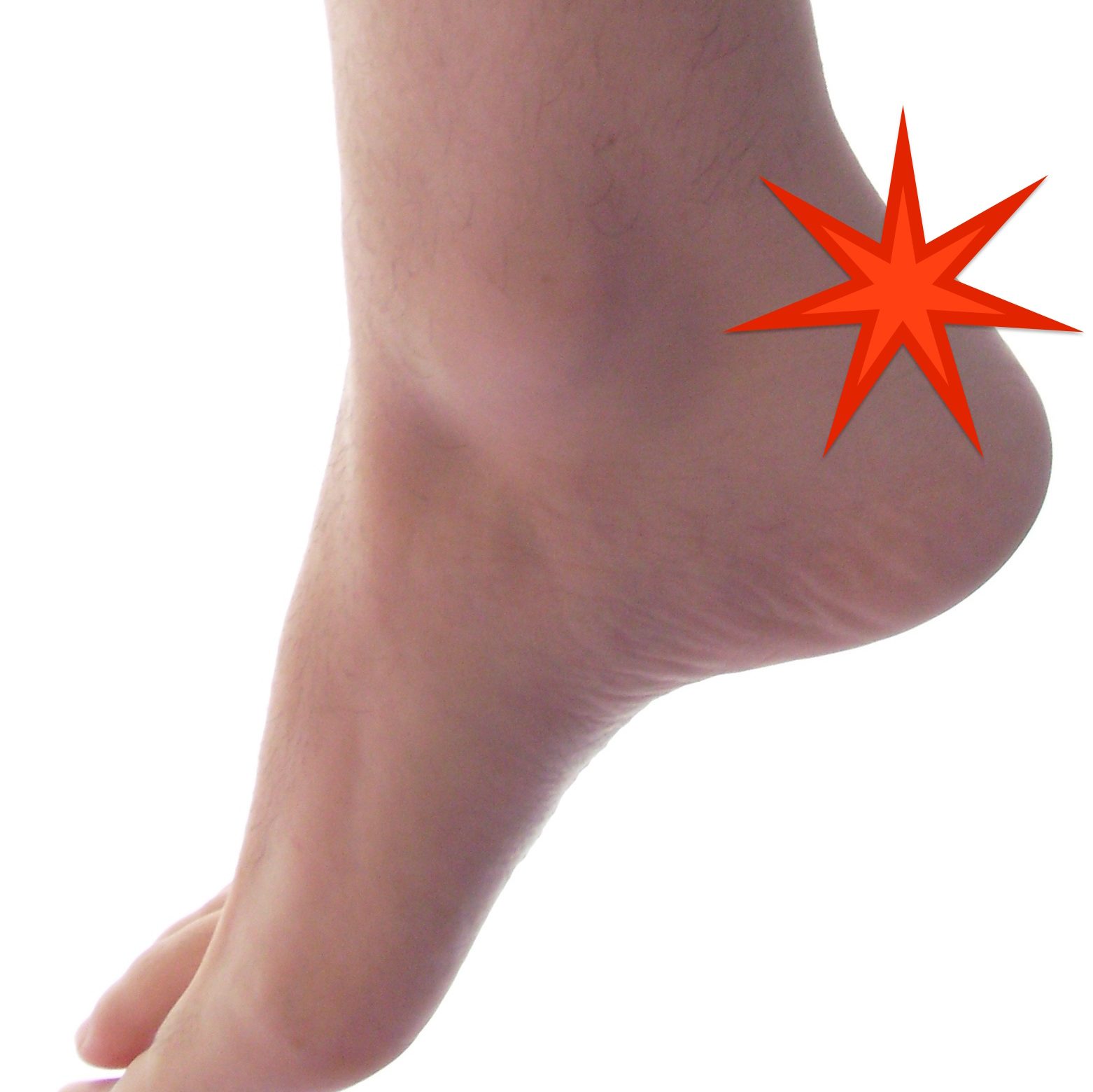 pain on the back of the heel